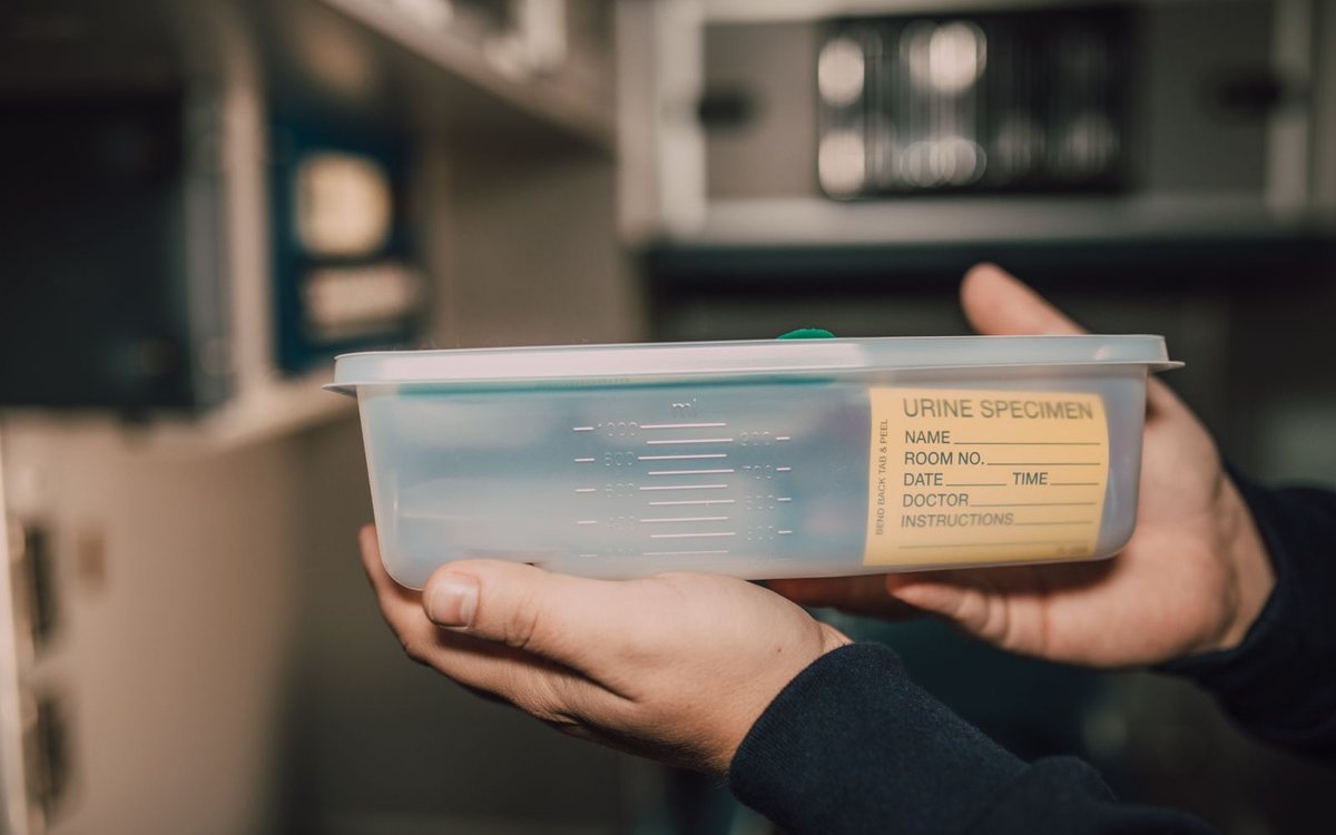 A urine specimen container held in a laboratory