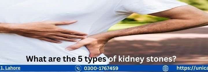 What are the 5 types of kidney stones?