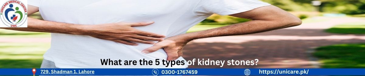 What are the 5 types of kidney stones?