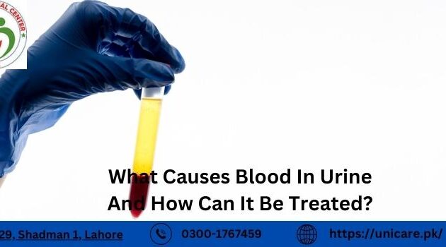 What Causes Blood In Urine And How Can It Be Treated?