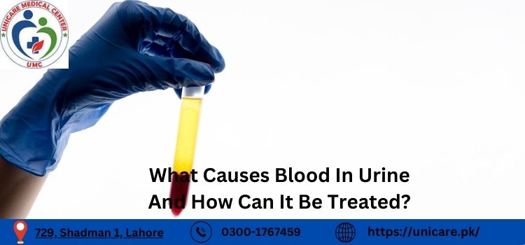 What Causes Blood In Urine And How Can It Be Treated?