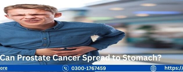 Can Prostate Cancer Spread to Stomach