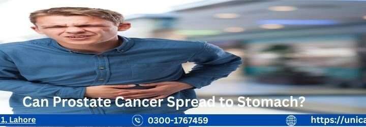 Can Prostate Cancer Spread to Stomach Can Prostate Cancer Spread to Stomach