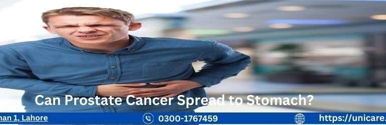 Can Prostate Cancer Spread to Stomach